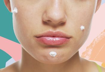 TREATING ACNE: THE ULTIMATE GUIDE FOR FIGHTING BREAKOUTS