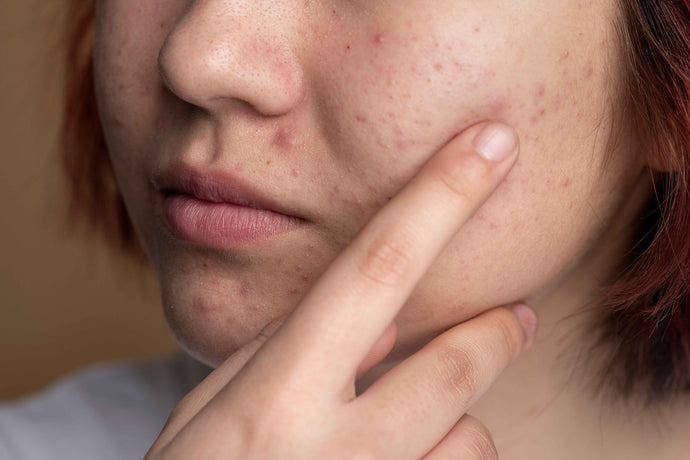 HOW TO SOOTHE & PROTECT EASILY IRRITATED OR SENSITIVE SKIN